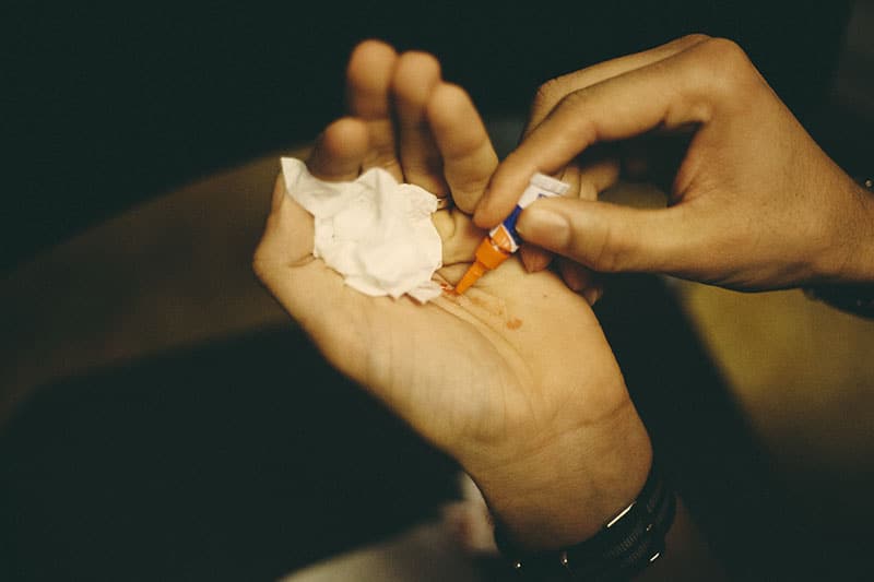 Super-Glue-For-Cuts-Medical-Uses-Crazyglue